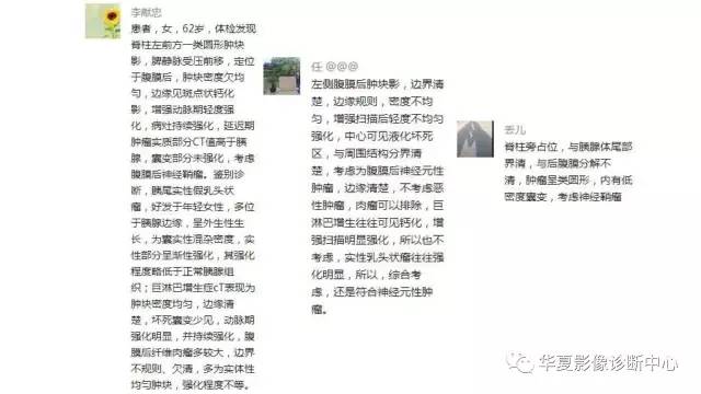 【病例】腹膜后神经鞘瘤1例CT影像表现
