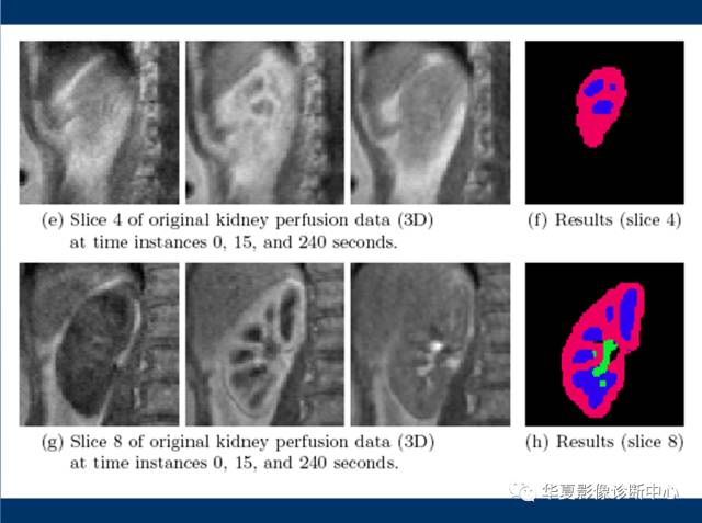 【PPT】磁共振成像（MRI）在肾功能检查中的应用