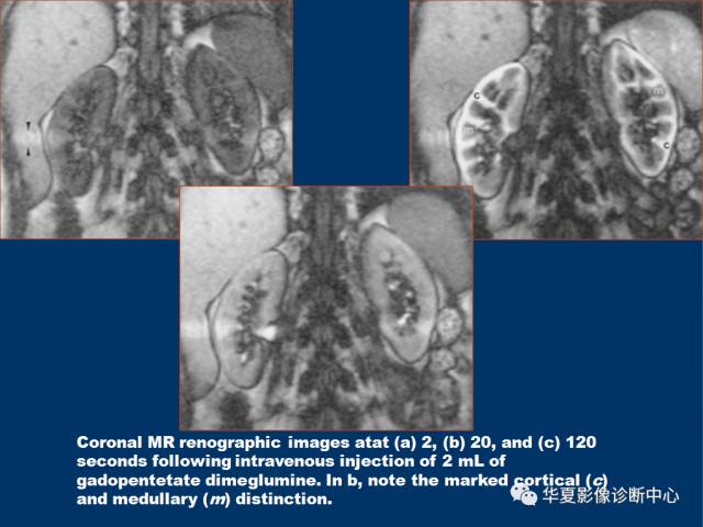 【PPT】磁共振成像（MRI）在肾功能检查中的应用