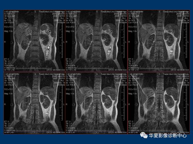 【PPT】磁共振成像（MRI）在肾功能检查中的应用