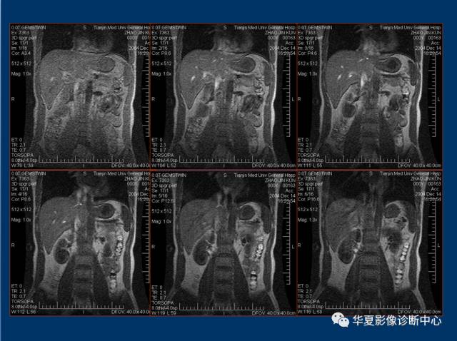 【PPT】磁共振成像（MRI）在肾功能检查中的应用