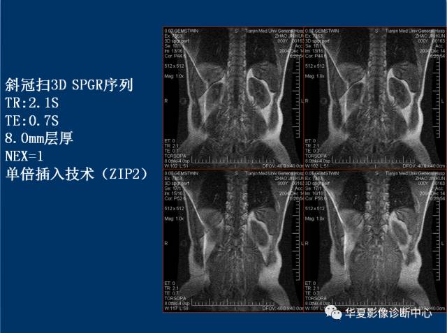 【PPT】磁共振成像（MRI）在肾功能检查中的应用
