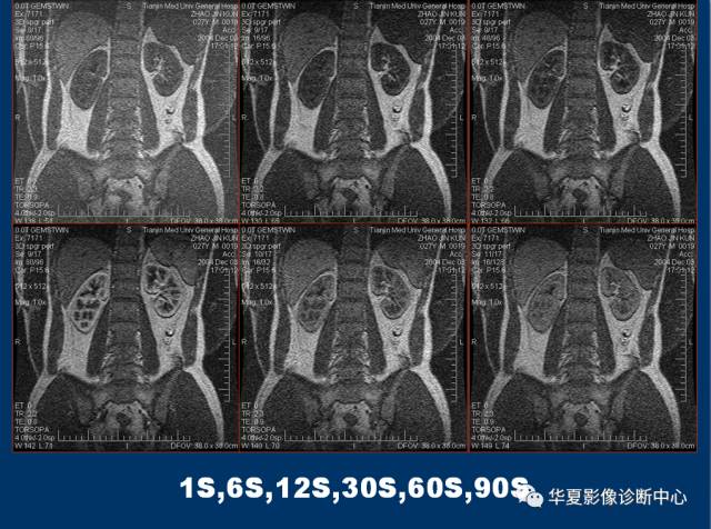 【PPT】磁共振成像（MRI）在肾功能检查中的应用
