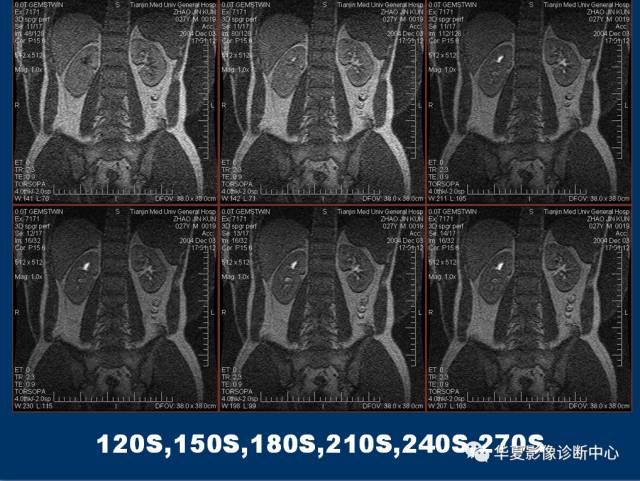 【PPT】磁共振成像（MRI）在肾功能检查中的应用