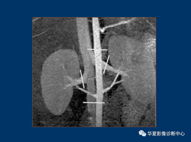 【PPT】磁共振成像（MRI）在肾功能检查中的应用