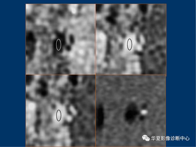 【PPT】磁共振成像（MRI）在肾功能检查中的应用