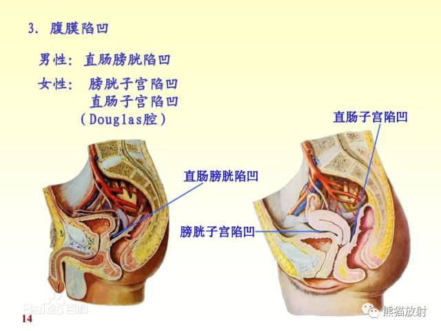 【解剖】腹膜及腹膜腔(经典讲解汇总) 【解剖】腹膜及腹膜腔(经典讲解汇总)