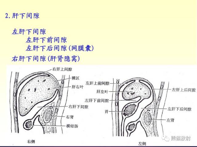 【解剖】腹膜及腹膜腔(经典讲解汇总) 【解剖】腹膜及腹膜腔(经典讲解汇总)