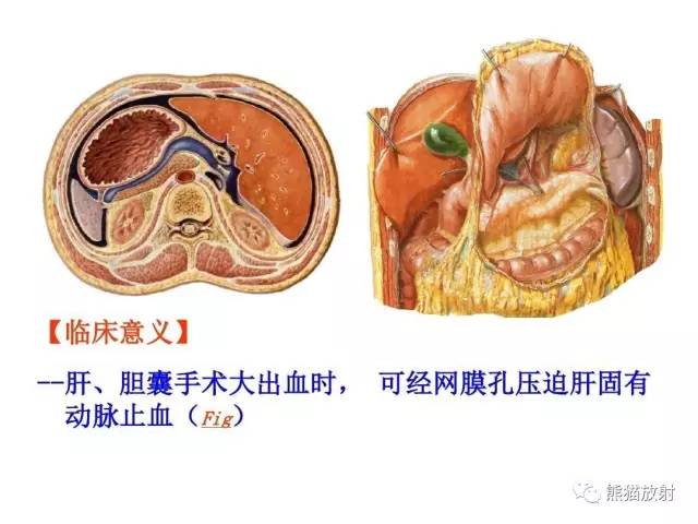 【解剖】腹膜及腹膜腔(经典讲解汇总) 【解剖】腹膜及腹膜腔(经典讲解汇总)