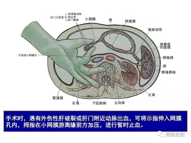 【解剖】腹膜及腹膜腔(经典讲解汇总) 【解剖】腹膜及腹膜腔(经典讲解汇总)