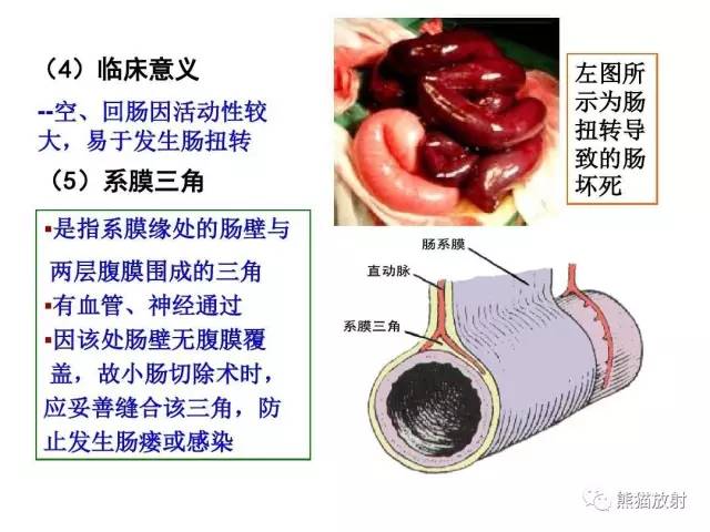 【解剖】腹膜及腹膜腔(经典讲解汇总) 【解剖】腹膜及腹膜腔(经典讲解汇总)