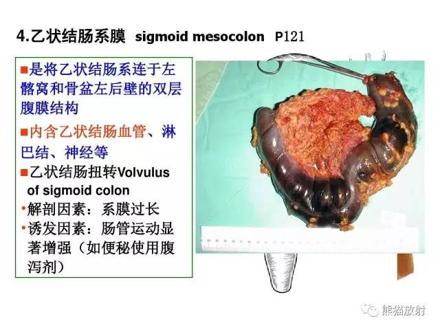 【解剖】腹膜及腹膜腔(经典讲解汇总) 【解剖】腹膜及腹膜腔(经典讲解汇总)
