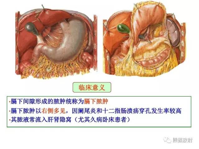 【解剖】腹膜及腹膜腔(经典讲解汇总) 【解剖】腹膜及腹膜腔(经典讲解汇总)