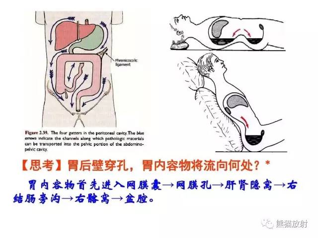 【解剖】腹膜及腹膜腔(经典讲解汇总) 【解剖】腹膜及腹膜腔(经典讲解汇总)