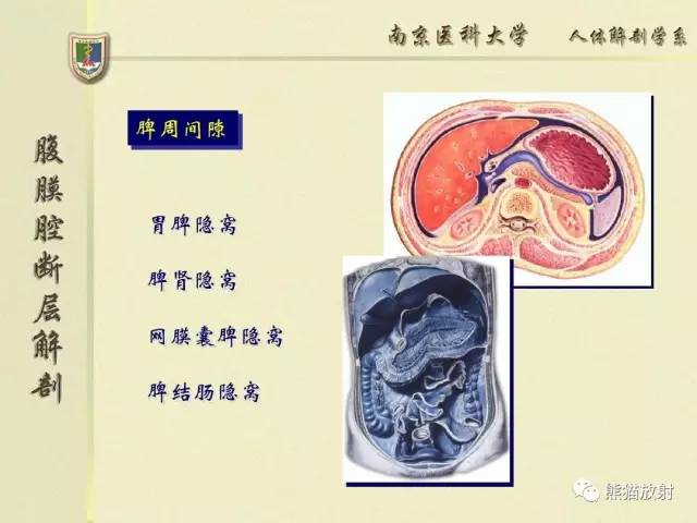 【解剖】腹膜及腹膜腔(经典讲解汇总) 【解剖】腹膜及腹膜腔(经典讲解汇总)