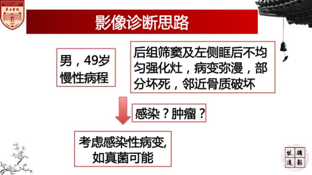 【病例】鼻腔鼻窦曲霉菌病累及颅内1例MR诊断分析