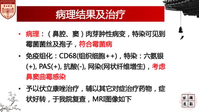 【病例】鼻腔鼻窦曲霉菌病累及颅内1例MR诊断分析