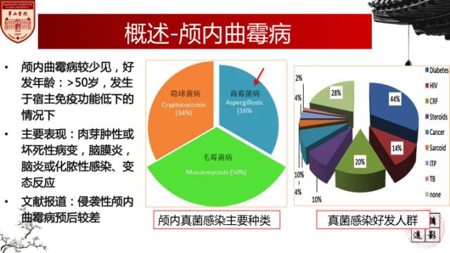 【病例】鼻腔鼻窦曲霉菌病累及颅内1例MR诊断分析