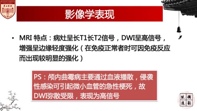 【病例】鼻腔鼻窦曲霉菌病累及颅内1例MR诊断分析