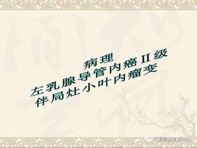 【PPT】乳腺导管原位癌的MRI诊断