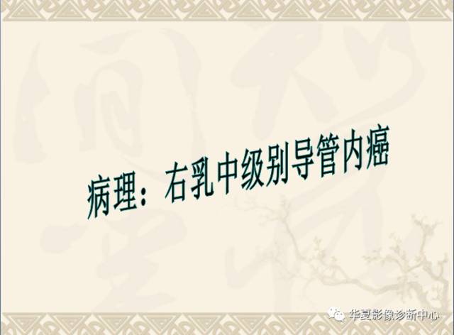 【PPT】乳腺导管原位癌的MRI诊断