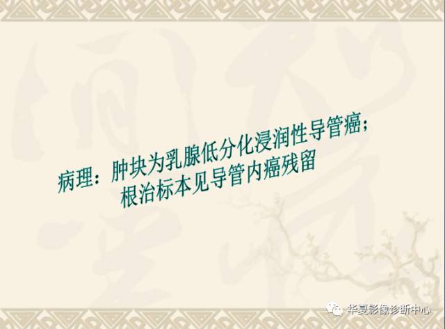 【PPT】乳腺导管原位癌的MRI诊断