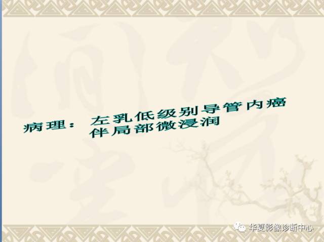 【PPT】乳腺导管原位癌的MRI诊断