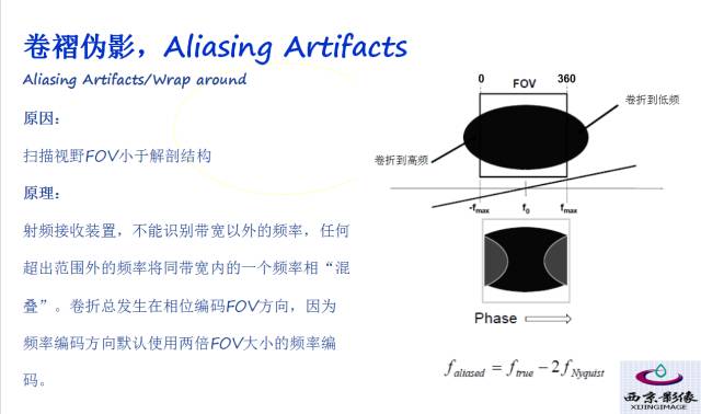 【PPT】磁共振常见伪影及对策