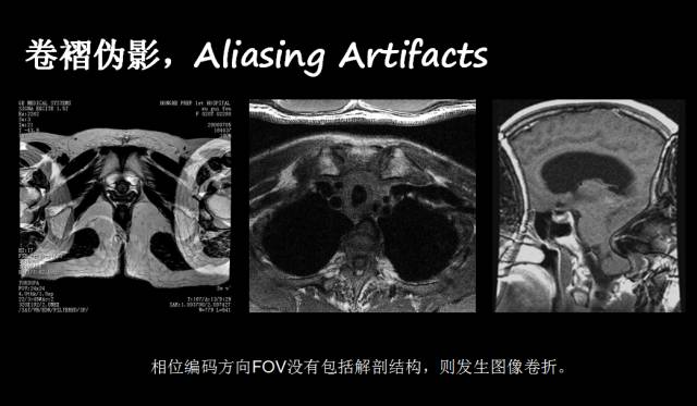 【PPT】磁共振常见伪影及对策