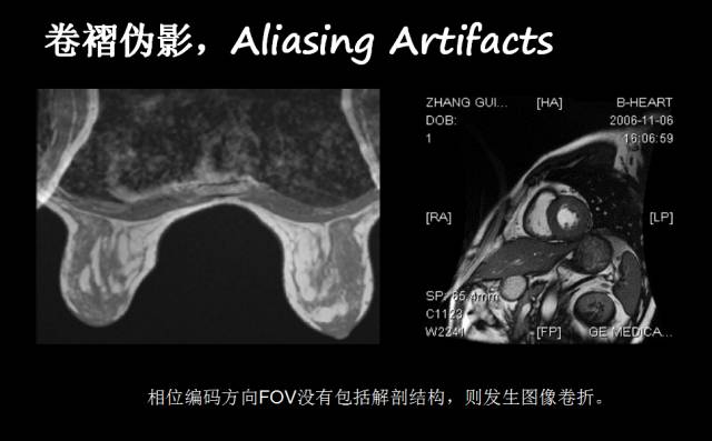 【PPT】磁共振常见伪影及对策