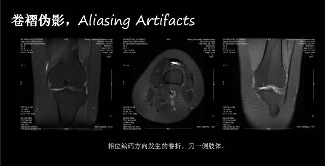 【PPT】磁共振常见伪影及对策