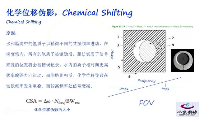 【PPT】磁共振常见伪影及对策