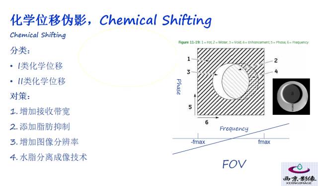 【PPT】磁共振常见伪影及对策