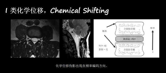 【PPT】磁共振常见伪影及对策