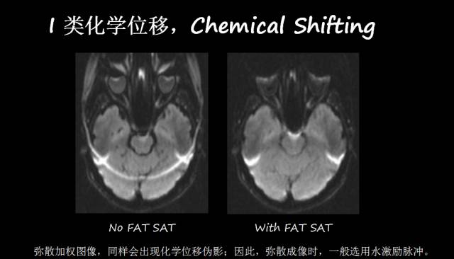 【PPT】磁共振常见伪影及对策