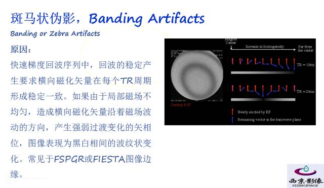 【PPT】磁共振常见伪影及对策