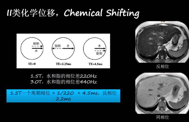 【PPT】磁共振常见伪影及对策