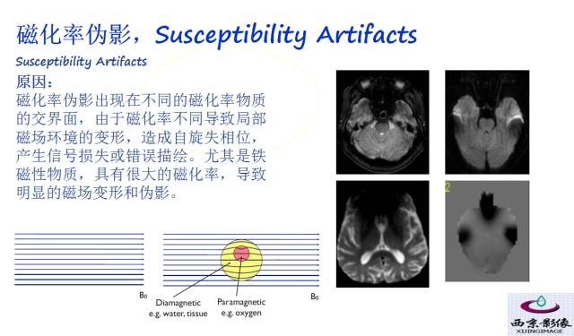 【PPT】磁共振常见伪影及对策