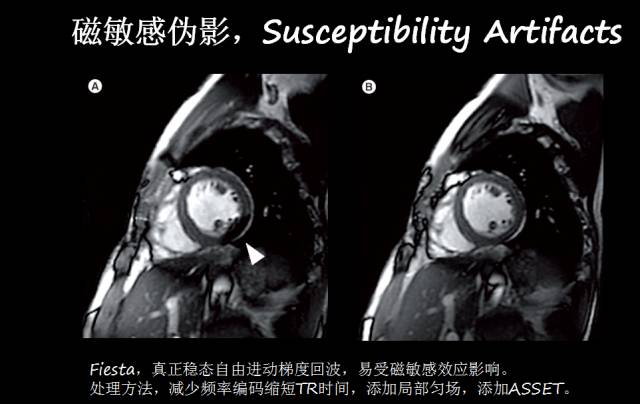 【PPT】磁共振常见伪影及对策