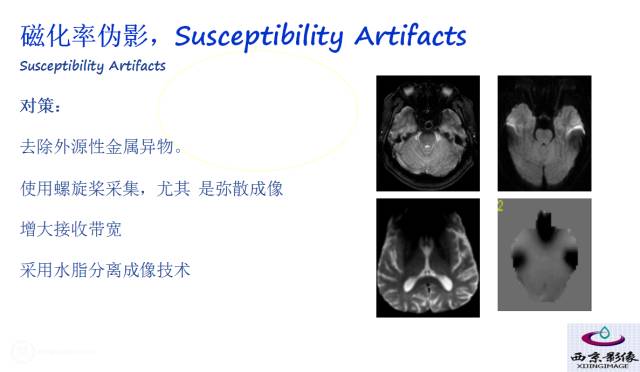 【PPT】磁共振常见伪影及对策