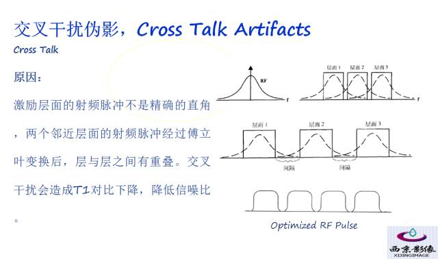 【PPT】磁共振常见伪影及对策