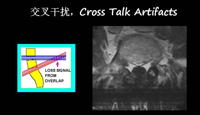 【PPT】磁共振常见伪影及对策