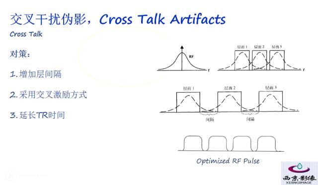 【PPT】磁共振常见伪影及对策