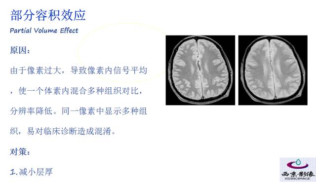 【PPT】磁共振常见伪影及对策