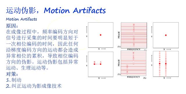 【PPT】磁共振常见伪影及对策