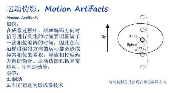 【PPT】磁共振常见伪影及对策
