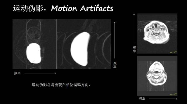【PPT】磁共振常见伪影及对策