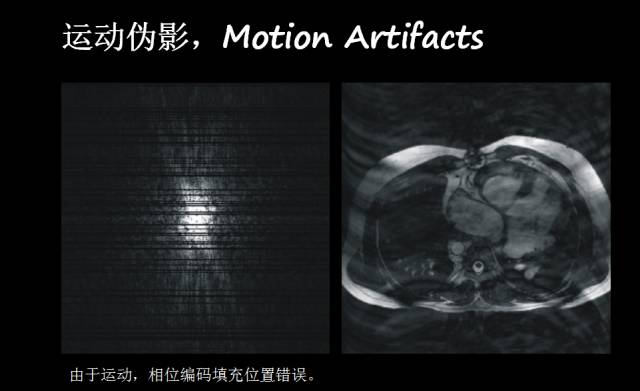 【PPT】磁共振常见伪影及对策