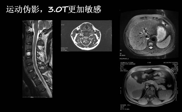 【PPT】磁共振常见伪影及对策