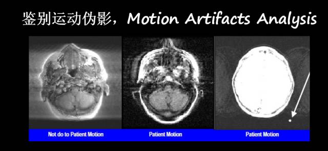 【PPT】磁共振常见伪影及对策